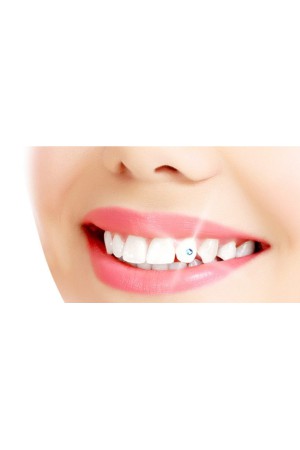 Diş Kristali Ve Diş Pırlantası Komple Set - Muhteşem Gülüş Seti